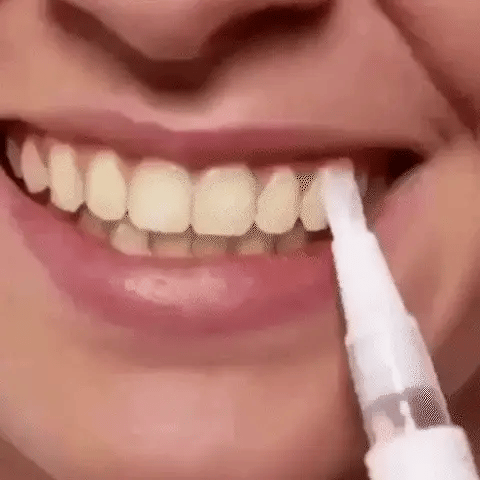 LAPIZ Blanqueador de Dientes